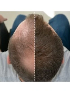 Fibras Capilares Con Keratina Color Marrón 25 G